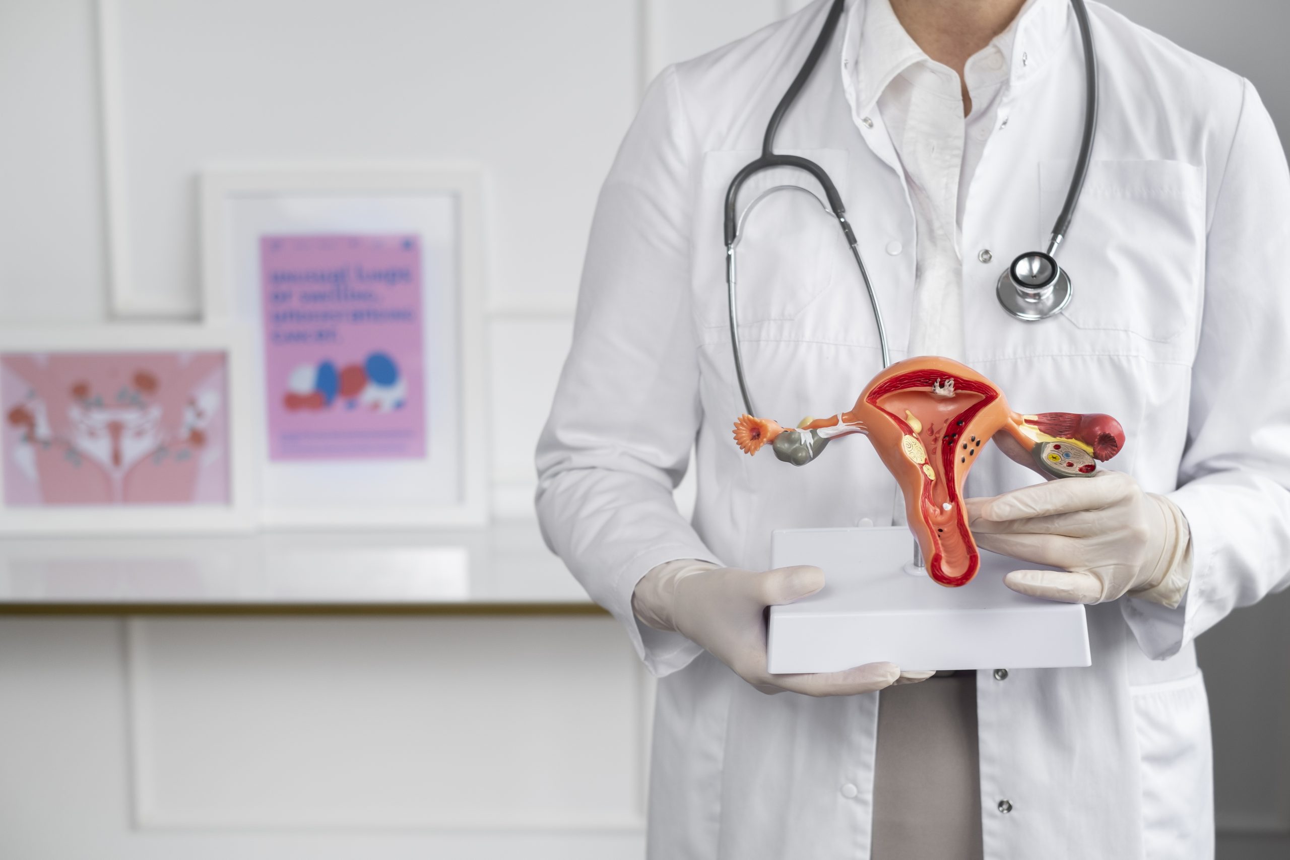 Diagnóstico e tratamento da Endometriose: o que toda mulher deve saber